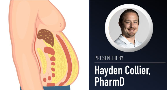 On Demand Webinar
